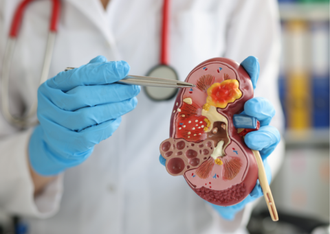 Quando devo procurar um urologista com urgência?