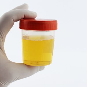 Você observa a cor da sua urina?