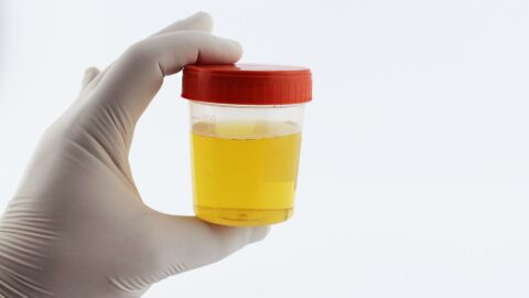 Você observa a cor da sua urina?